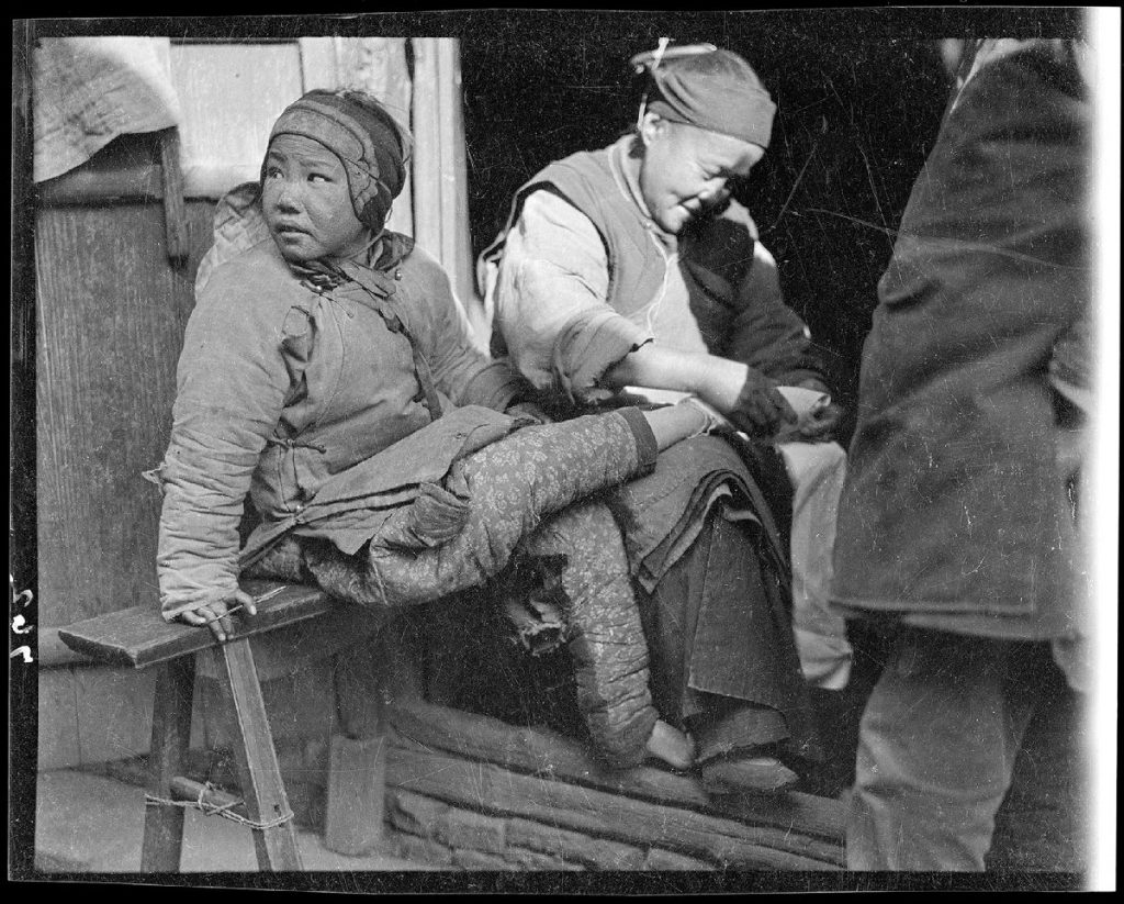 Older woman adjusting the bindings on a girl’s foot, 1917–1919, in Shilin, Zhejiang Province, China